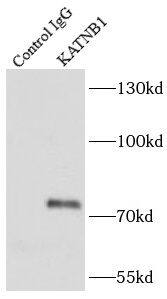 Immunoprecipitation: katanin-p80 Antibody - BSA Free [NBP3-46439] - IP Result of anti-katanin-p80 antibody(IP: , 3μg; Detection:  1:500)with Hela cells lysate 3000μg.