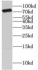 Western Blot: katanin-p80 Antibody - BSA Free [NBP3-46439] - HeLa cells were subjected to SDS PAGE followed by western blot with (katanin-p80 antibody) at dilution of 1:300