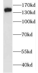 Western Blot: JNK/JIP3 Antibody - BSA Free [NBP3-46445] - Rat brain tissue were subjected to SDS PAGE followed by western blot with (JNK/JIP3 Antibody) at dilution of 1:600