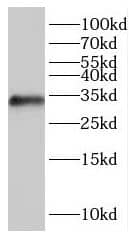 Western Blot: IYD Antibody - BSA Free [NBP3-46448] - Human liver tissue were subjected to SDS PAGE followed by western blot with (IYD antibody) at dilution of 1:1000