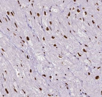 Immunohistochemistry: IP3KC Antibody - BSA Free [NBP3-46451] - Immunohistochemistry of paraffin-embedded human skeletal muscle tissue slide using (IP3KC Antibody) at dilution of 1:50