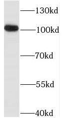 Western Blot: IP3KC Antibody - BSA Free [NBP3-46451] - Human heart tissue were subjected to SDS PAGE followed by western blot with (IP3KC antibody) at dilution of 1:400