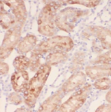 Immunohistochemistry: IQSEC2 Antibody - BSA Free [NBP3-46459] - Immunohistochemistry of paraffin-embedded human kidney tissue slide using (IQSEC2 antibody) at dilution of 1:50