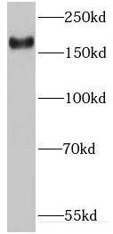 Western Blot: IQGAP3 Antibody - BSA Free [NBP3-46460] - A549 cells were subjected to SDS PAGE followed by western blot with (IQGAP3 antibody) at dilution of 1:2000