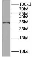 Western Blot: IQCK Antibody - BSA Free [NBP3-46461] - Mouse testis tissue were subjected to SDS PAGE followed by western blot with (IQCK Antibody) at dilution of 1:600