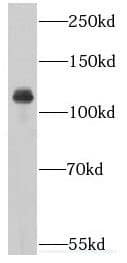 Western Blot Importin4 Antibody - BSA Free