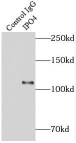 Immunoprecipitation Importin4 Antibody - BSA Free