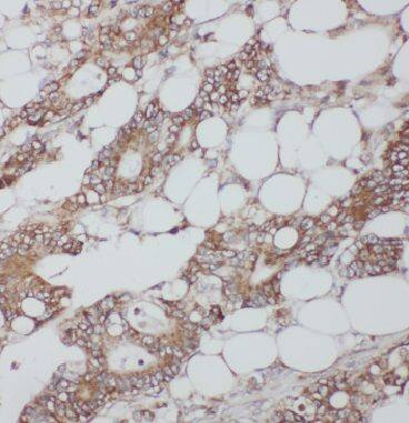 Immunohistochemistry Importin4 Antibody - BSA Free