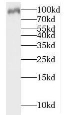 Western Blot: Importin-13 Antibody - BSA Free [NBP3-46464] - Human brain tissue were subjected to SDS PAGE followed by western blot with (Importin-13 antibody) at dilution of 1:500