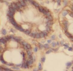 Immunohistochemistry: PLA2G6 Antibody - BSA Free [NBP3-46465] - Immunohistochemistry of paraffin-embedded human small intestine tissue slide using (PLA2G6 Antibody) at dilution of 1:50