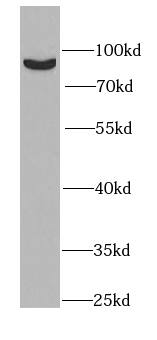 Western Blot: PLA2G6 Antibody - BSA Free [NBP3-46465] - Mouse testis tissue were subjected to SDS PAGE followed by western blot with (PLA2G6 antibody) at dilution of 1:1000