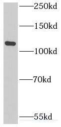 Western Blot: INT3 Antibody - BSA Free [NBP3-46472] - HeLa cells were subjected to SDS PAGE followed by western blot with (INT3 antibody) at dilution of 1:500