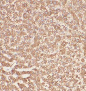 Immunohistochemistry: INSIG-2 Antibody - BSA Free [NBP3-46474] - Immunohistochemistry of paraffin-embedded human liver tissue slide using (INSIG-2 Antibody) at dilution of 1:50