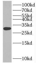 Western Blot: INSIG-2 Antibody - BSA Free [NBP3-46474] - Rat liver tissue were subjected to SDS PAGE followed by western blot with (INSIG-2 Antibody) at dilution of 1:1000