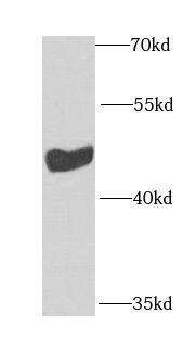 Western Blot SKIP Antibody - BSA Free