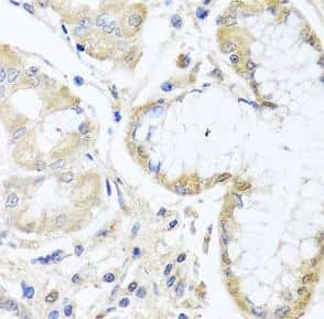 Immunohistochemistry: SKIP Antibody - BSA Free [NBP3-46476] - Immunohistochemistry of paraffin-embedded human stomach using (SKIP antibody) at dilution of 1:50