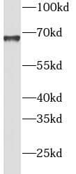 Western Blot INPP5E Antibody - BSA Free