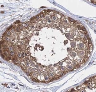 Immunohistochemistry INPP5E Antibody - BSA Free