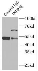 Immunoprecipitation INPP5E Antibody - BSA Free