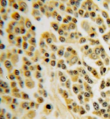 Immunohistochemistry INPP5B Antibody - BSA Free