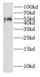 Western Blot IGSF21 Antibody - BSA Free