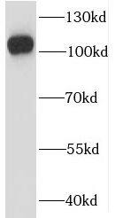 Western Blot: IGHMBP2 Antibody - BSA Free [NBP3-46486] - HL-60 cells were subjected to SDS PAGE followed by western blot with (IGHMBP2 Antibody) at dilution of 1:600