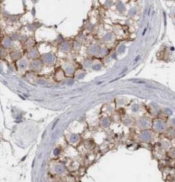 Immunohistochemistry IFT43 Antibody - BSA Free