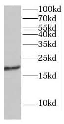 Western Blot: RABL4 Antibody - BSA Free [NBP3-46490] - Human RPE cells were subjected to SDS PAGE followed by western blot with (IFT27 antibody) at dilution of 1:500