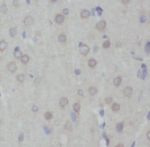 Immunohistochemistry: RABL4 Antibody - BSA Free [NBP3-46490] - Immunohistochemistry of paraffin-embedded human brain tissue slide using (RABL4 Antibody) at dilution of 1:50