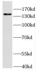 Western Blot IFT140 Antibody - BSA Free