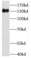 Western Blot: IFT122 Antibody - BSA Free [NBP3-46494] - Mouse testis tissue were subjected to SDS PAGE followed by western blot with (IFT122 Antibody) at dilution of 1:300