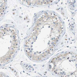 Immunohistochemistry: IFT122 Antibody - BSA Free [NBP3-46494] - Immunohistochemistry of paraffin-embedded human testis tissue slide using (IFT122 Antibody) at dilution of 1:50
