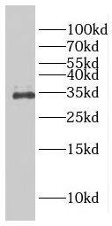 Western Blot FAM78A Antibody - BSA Free