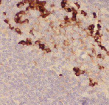 Immunohistochemistry FAM78A Antibody - BSA Free