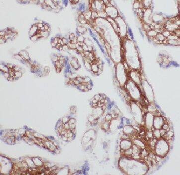 Immunohistochemistry: FAM76A Antibody - BSA Free [NBP3-46501] - Immunohistochemistry of paraffin-embedded human placenta using (FAM76A antibody) at dilution of 1:50