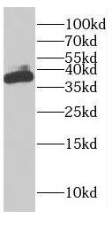 Western Blot: FAM76A Antibody - BSA Free [NBP3-46501] - HeLa cells were subjected to SDS PAGE followed by western blot with (FAM76A antibody) at dilution of 1:500