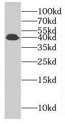 Western Blot: FAM71F2 Antibody - BSA Free [NBP3-46503] - PC-3 cells were subjected to SDS PAGE followed by western blot with ( FAM71F2 Antibody) at dilution of 1:2000