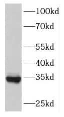 Western Blot: FAM71E2 Antibody - BSA Free [NBP3-46504] - Human brain tissue were subjected to SDS PAGE followed by western blot with (FAM71E2 antibody) at dilution of 1:1000