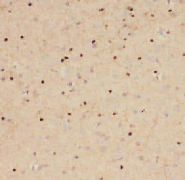 Immunohistochemistry: FAM71E2 Antibody - BSA Free [NBP3-46504] - Immunohistochemistry of paraffin-embedded human brain using (FAM71E2 antibody) at dilution of 1:50