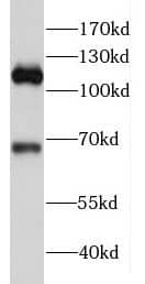Western Blot: FAM65B Antibody - BSA Free [NBP3-46505] - Human skeletal muscle tissue were subjected to SDS PAGE followed by western blot with (FAM65B antibody) at dilution of 1:500