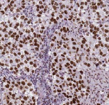 Immunohistochemistry: FAM48A Antibody - BSA Free [NBP3-46508] - Immunohistochemistry of paraffin-embedded human testis tissue slide using (FAM48A Antibody) at dilution of 1:50