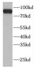 Western Blot: FAM48A Antibody - BSA Free [NBP3-46508] - PC-3 cells were subjected to SDS PAGE followed by western blot with (FAM48A Antibody) at dilution of 1:300