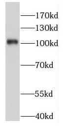 Western Blot FAM160B1 Antibody - BSA Free