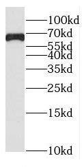 Western Blot: FAM13A Antibody - BSA Free [NBP3-46518] - Mouse kidney tissue were subjected to SDS PAGE followed by western blot with (FAM13A antibody) at dilution of 1:500