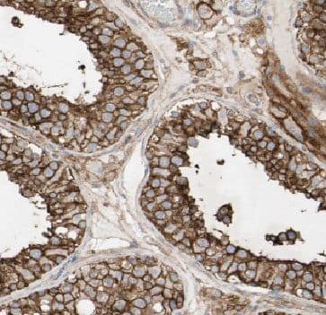 Immunohistochemistry: FAM133A Antibody - BSA Free [NBP3-46519] - Immunohistochemistry of paraffin-embedded human testis tissue using (FAM133A antibody) at dilution of 1:50