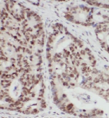 Immunohistochemistry: FAM127B Antibody - BSA Free [NBP3-46521] - Immunohistochemistry of paraffin-embedded human colon using (FAM127B antibody) at dilution of 1:100