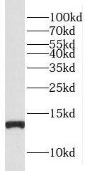 Western Blot: FAM127B Antibody - BSA Free [NBP3-46521] - PC-3 cells were subjected to SDS PAGE followed by western blot with (FAM127B antibody) at dilution of 1:500