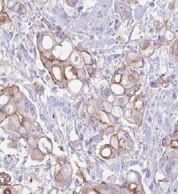 Immunohistochemistry CXX1 Antibody - BSA Free
