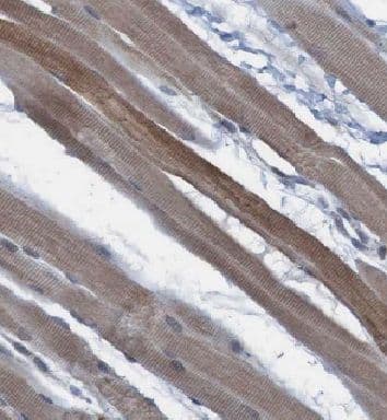 Immunohistochemistry: FAM120A Antibody - BSA Free [NBP3-46524] - Immunohistochemistry of paraffin-embedded human skeletal muscle using (FAM120A antibody) at dilution of 1:50