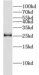 Western Blot: FAM119A Antibody - BSA Free [NBP3-46525] - L02 cells were subjected to SDS PAGE followed by western blot with (FAM119A antibody) at dilution of 1:800